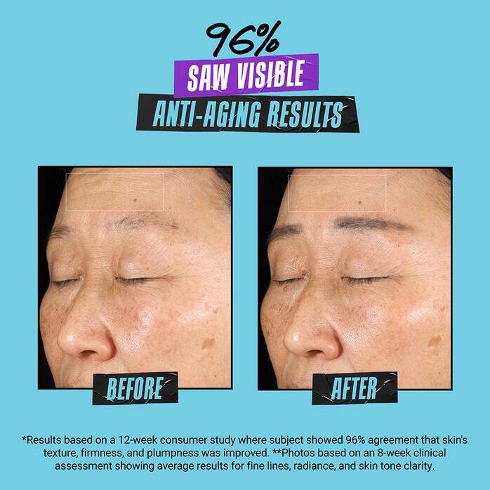 Super Multi Corrective Soft Cream