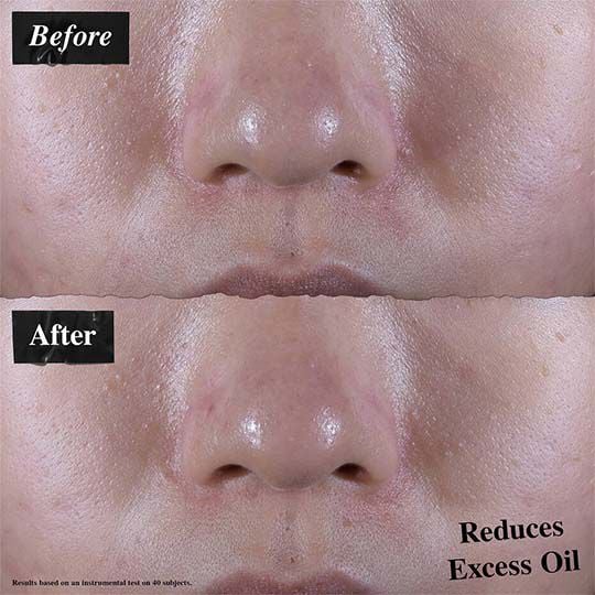 Ultra Facial Oil Free Gel Cream Set