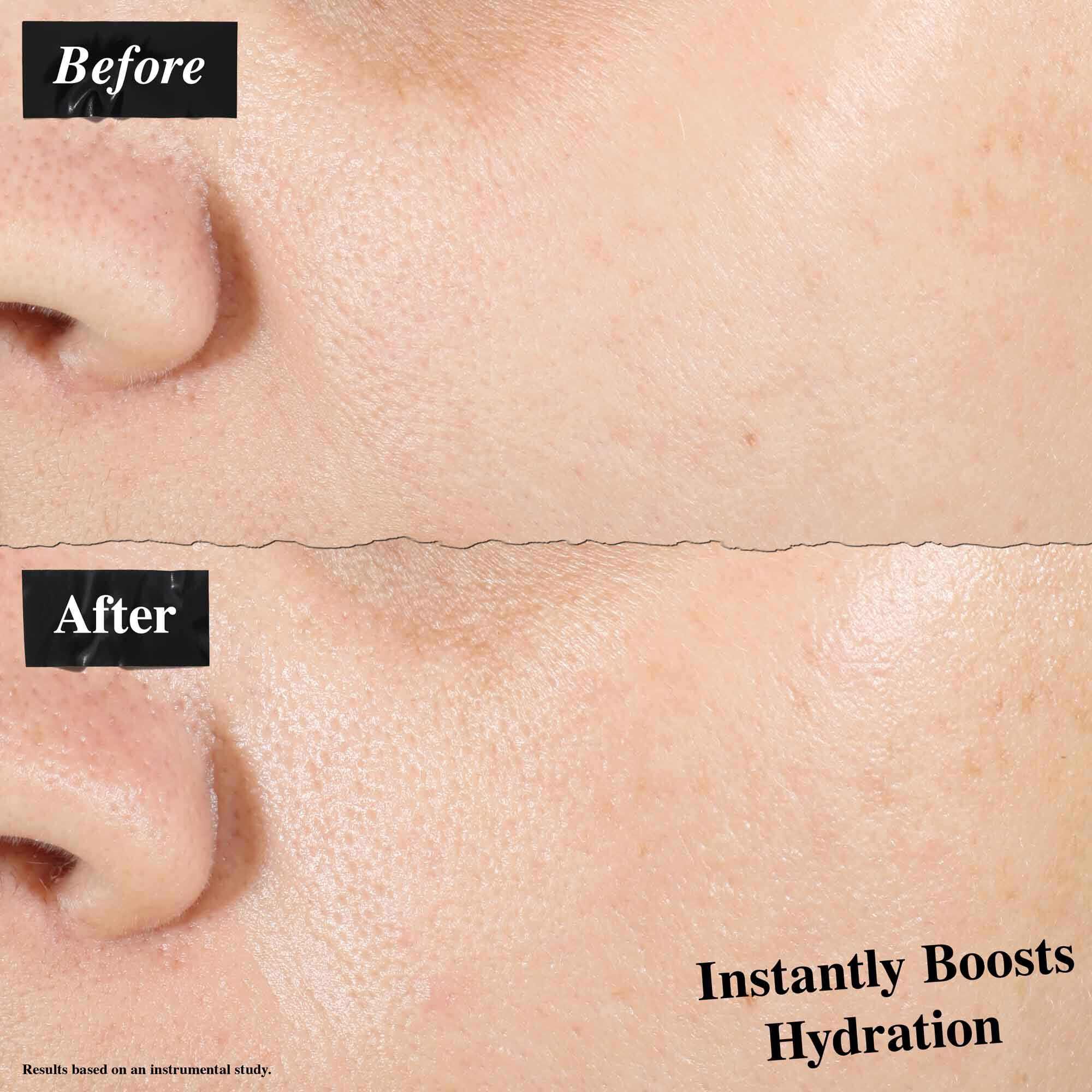 Ultra Pure High-Potency Serum 1.5% Hyaluronic Acid