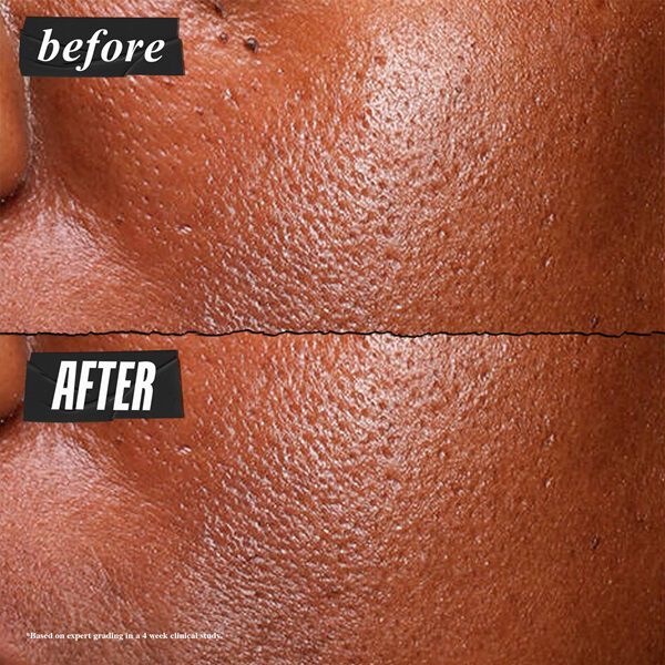 Ultra Pure High-Potency Serum 5.0% Niacinamide