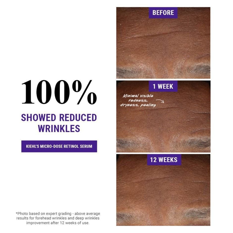 Micro-Dose Anti-Aging Retinol Serum | Kiehl's Singapore