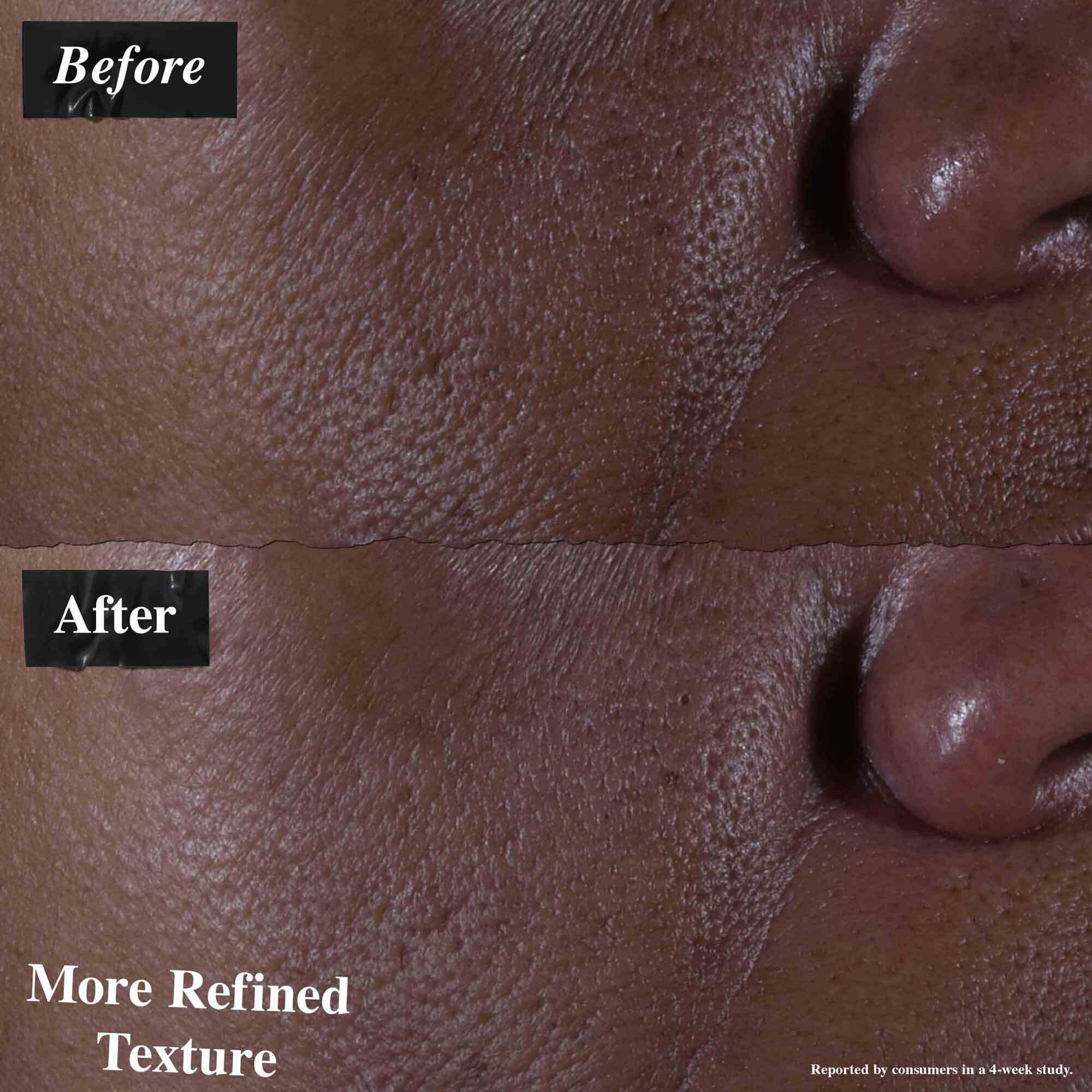 Ultra Pure High-Potency Serum 9.8% Glycolic Acid