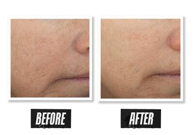 Before and after